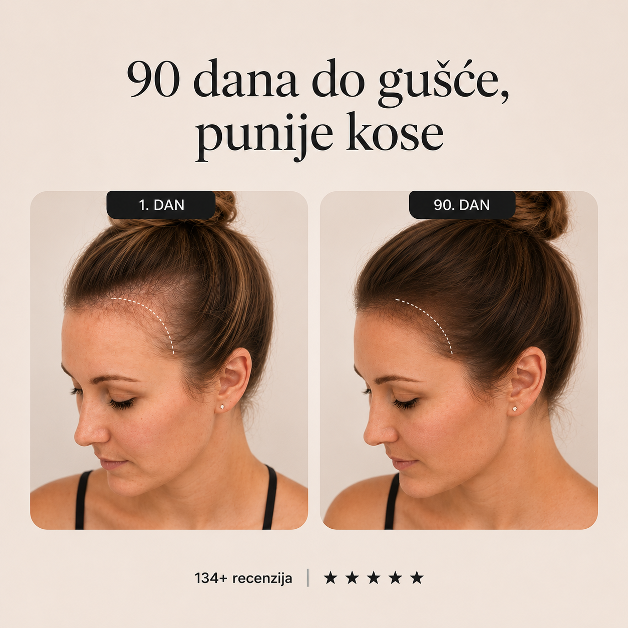 Serum za kosu