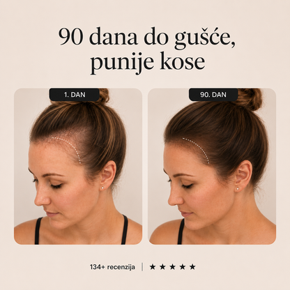 Serum za kosu